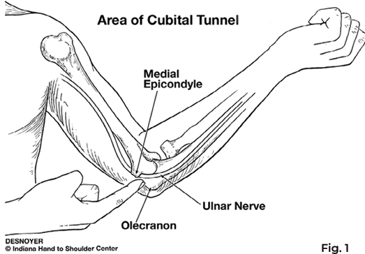 area of cubital tunnel diagram