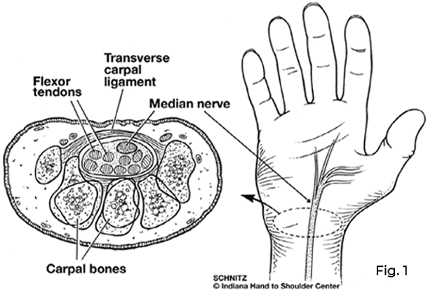 cross section of carpal tunnel