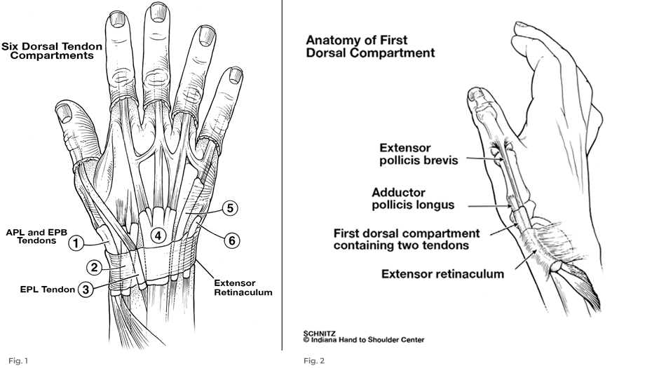 de Quervain’s stenosing tenosynovitis - tendon compartments and anatomy of first dorsal compartment