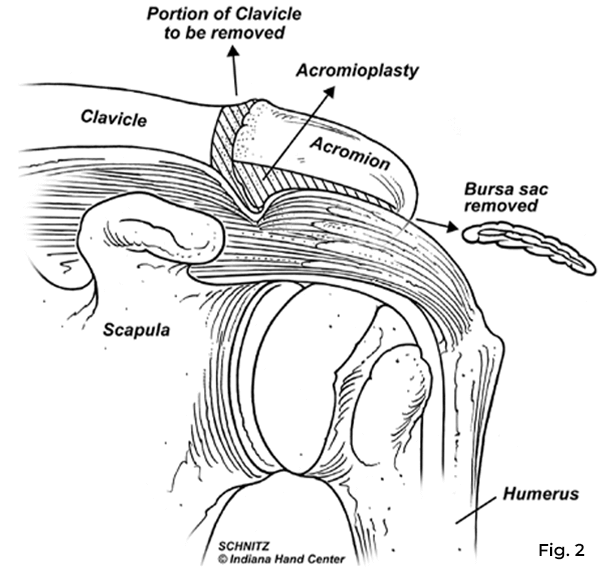 shoulder diagram