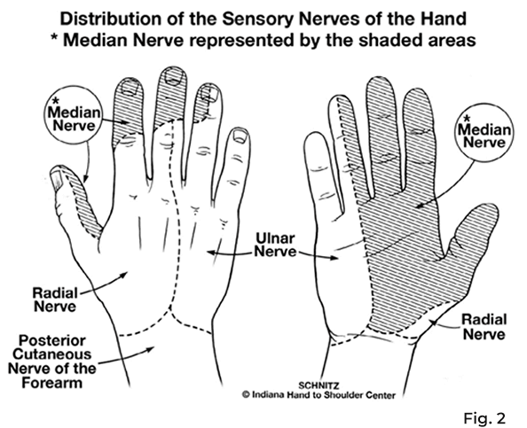 areas of median nerve sensation